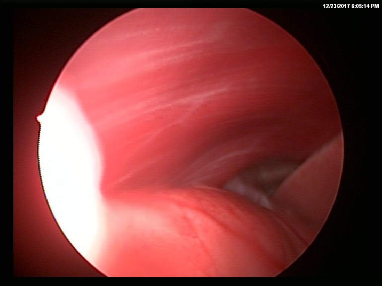 surgery-10